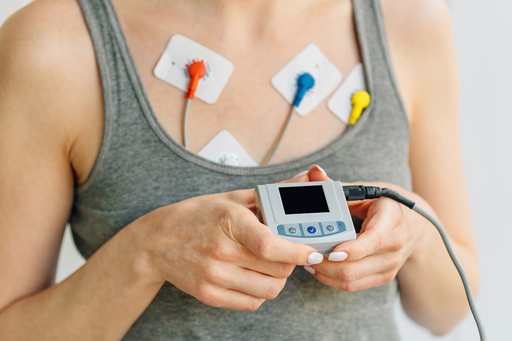 ECG Holter Monitoring